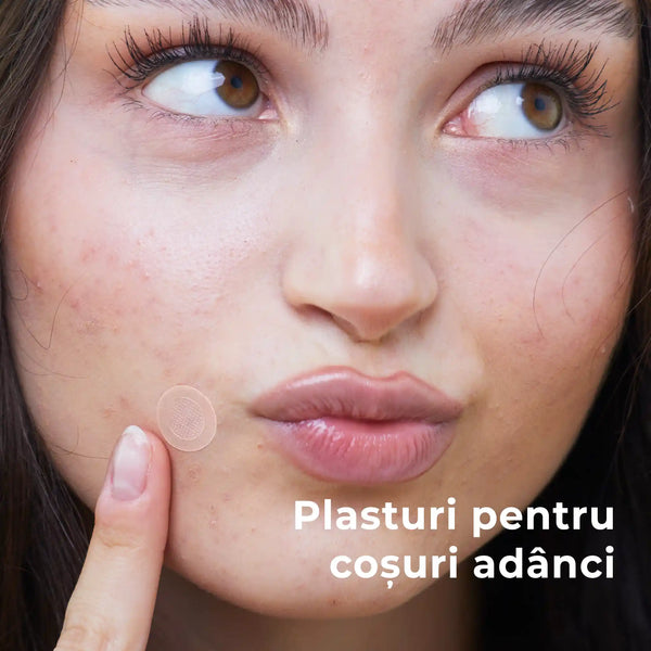 Kit Plasturi Coșuri WOW Patch