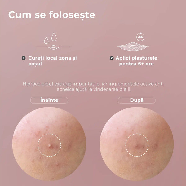 Kit Plasturi Coșuri WOW Patch