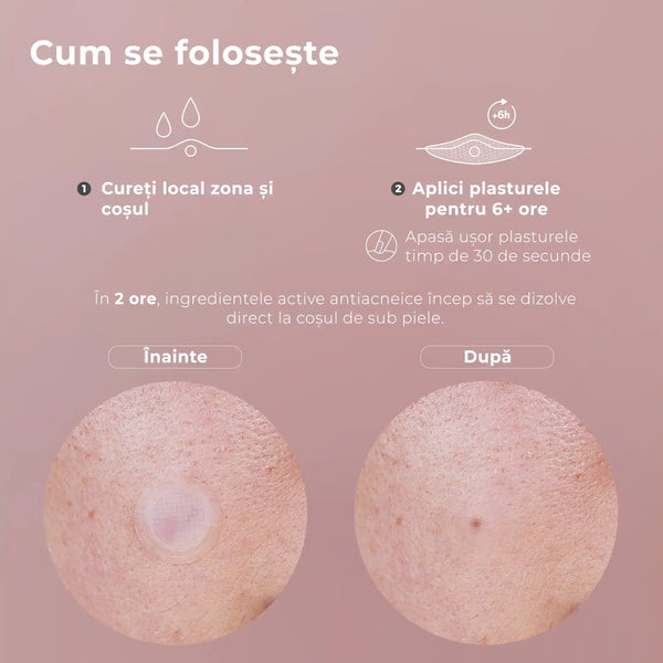 Kit Plasturi Coșuri WOW Patch